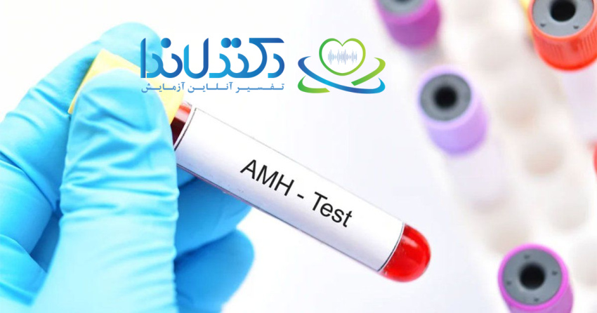 تفسیر آزمایش amh