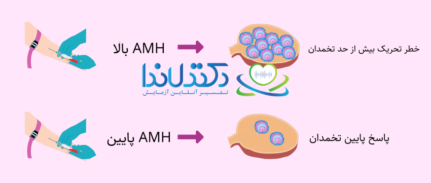 سطح بالای AMH میتواند نشاندهنده خطر تحریک بیشازحد تخمدان باشد، در حالی که سطح پایین آن اغلب بیانگر پاسخ ضعیف تخمدان به تحریک هورمونی است. این نکته در تفسیر آزمایش AMH و برنامهریزی درمان ناباروری اهمیت دارد.