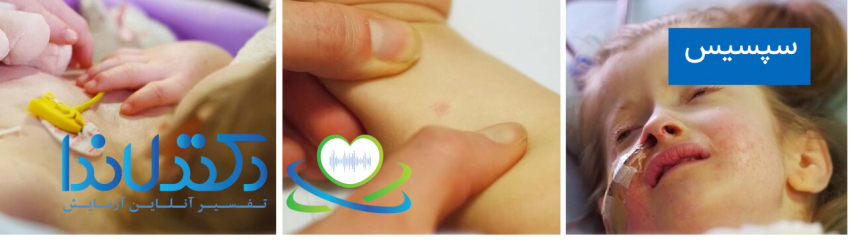 مراقبتهای پزشکی فوری در بیمار دچار سپسیس، یکی از علل مهم بالا بودن PCT در آزمایش خون