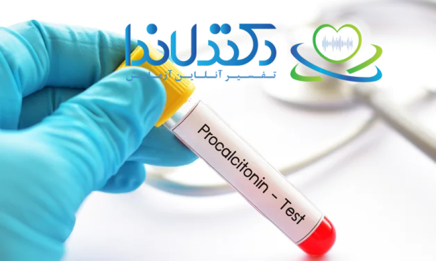 علت بالا و پایین بودن PCT در آزمایش خون