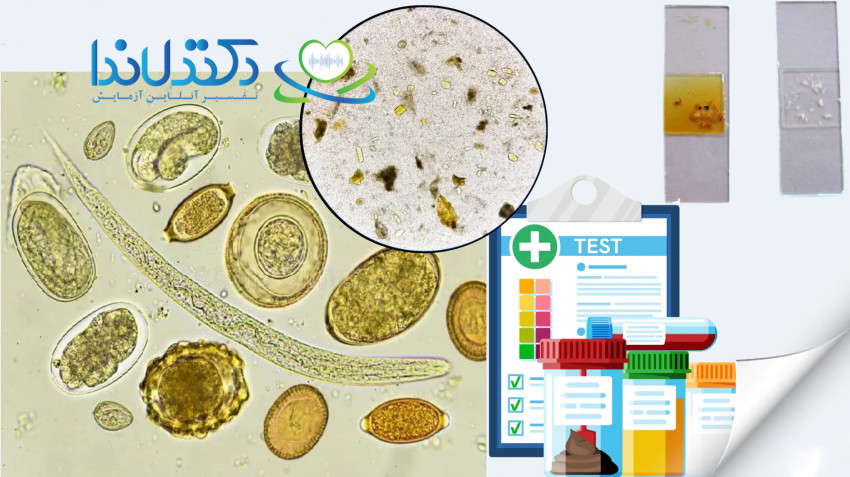 تفسیر آزمایش مدفوع