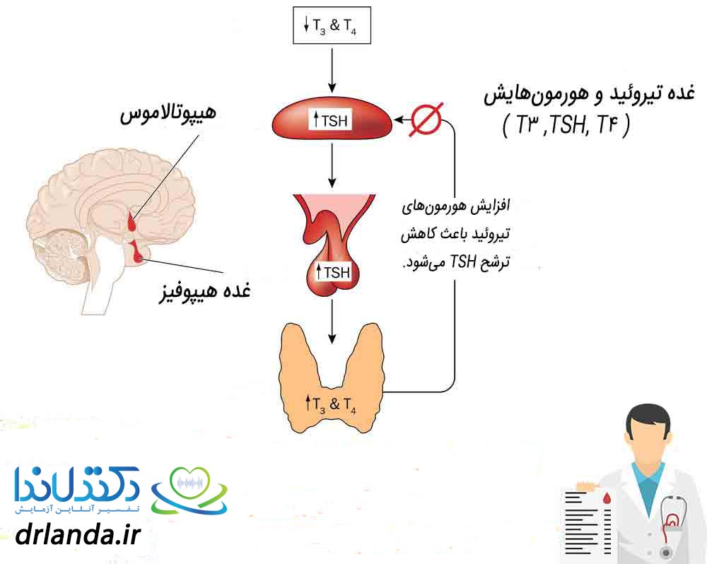 تفسیر آزمایش تیروئید دکتر لاندا