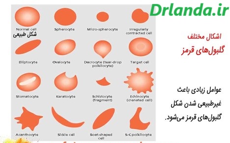 اشکال مختلف گلبول های قرمز