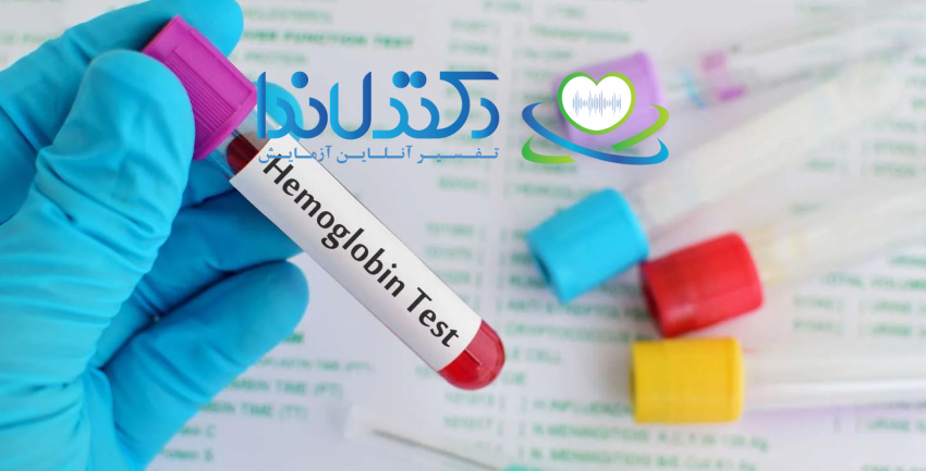 HGB in blood test