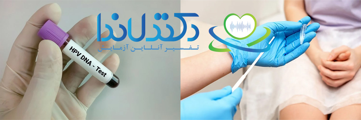 آزمایش اچ پی وی