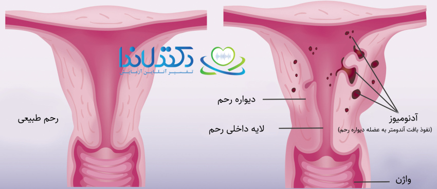 خواندن جواب پاتولوژی رحم