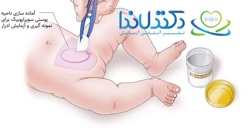 تفسیر جواب آزمایش کشت ادرار نوزاد