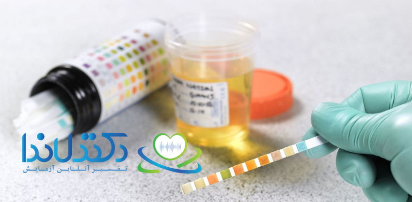 تفسیر آزمایش قند ادرار