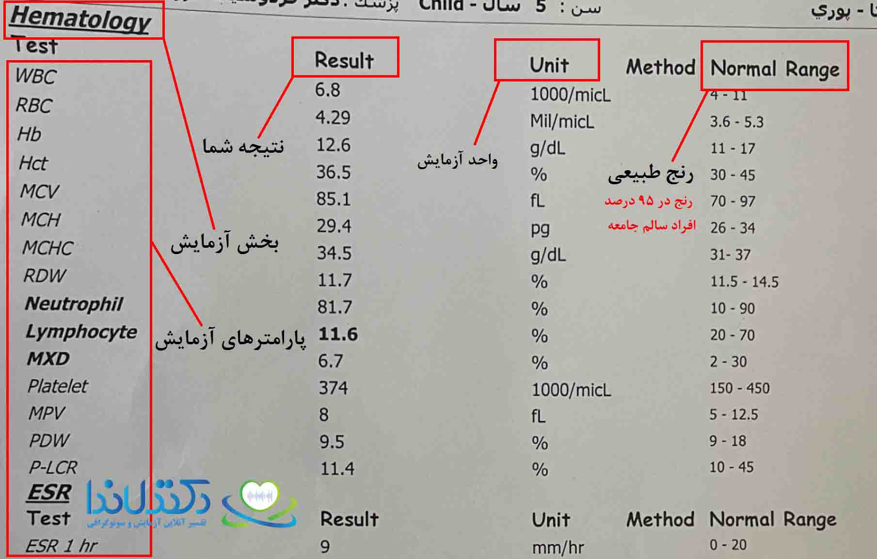 تفسیر آزمایش cbc
