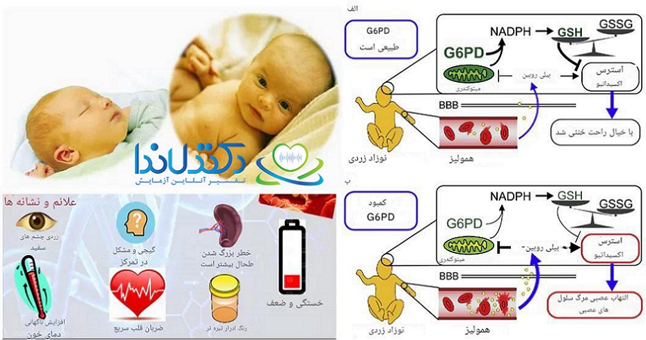 علائم فاویسم