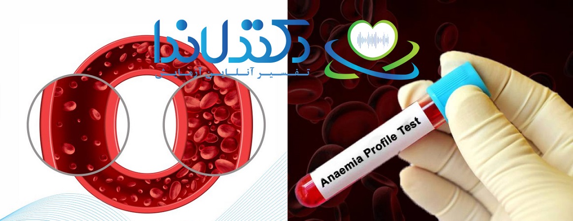 آزمایش کم خونی