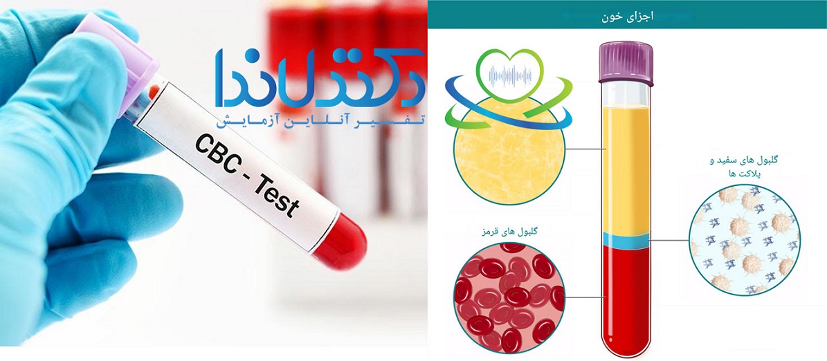 آزمایش خون cbc