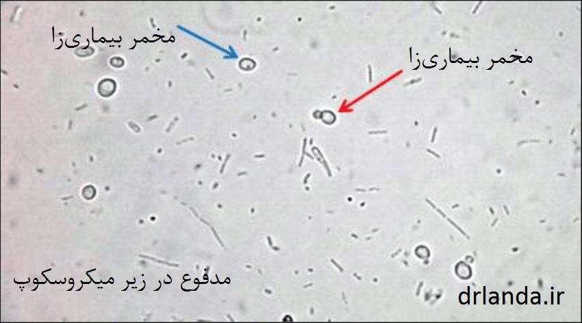 تفسیر آزمایش مدفوع