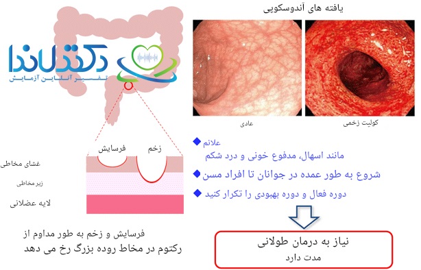 مشکلات گوارش