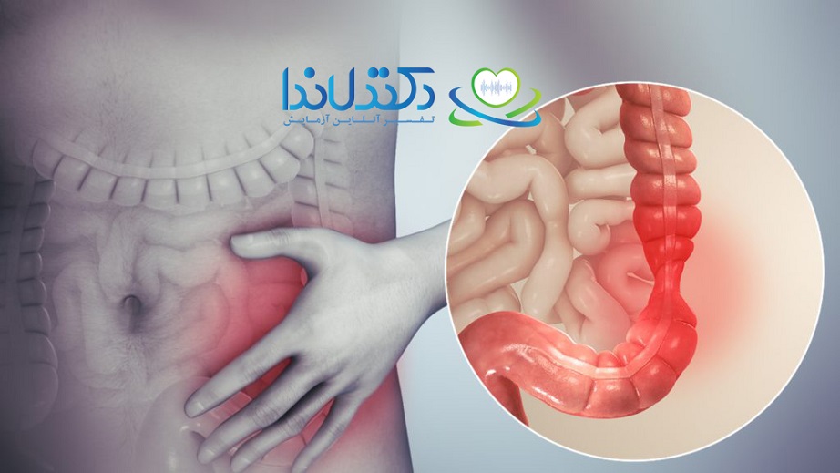 آزمایش خون برای روده