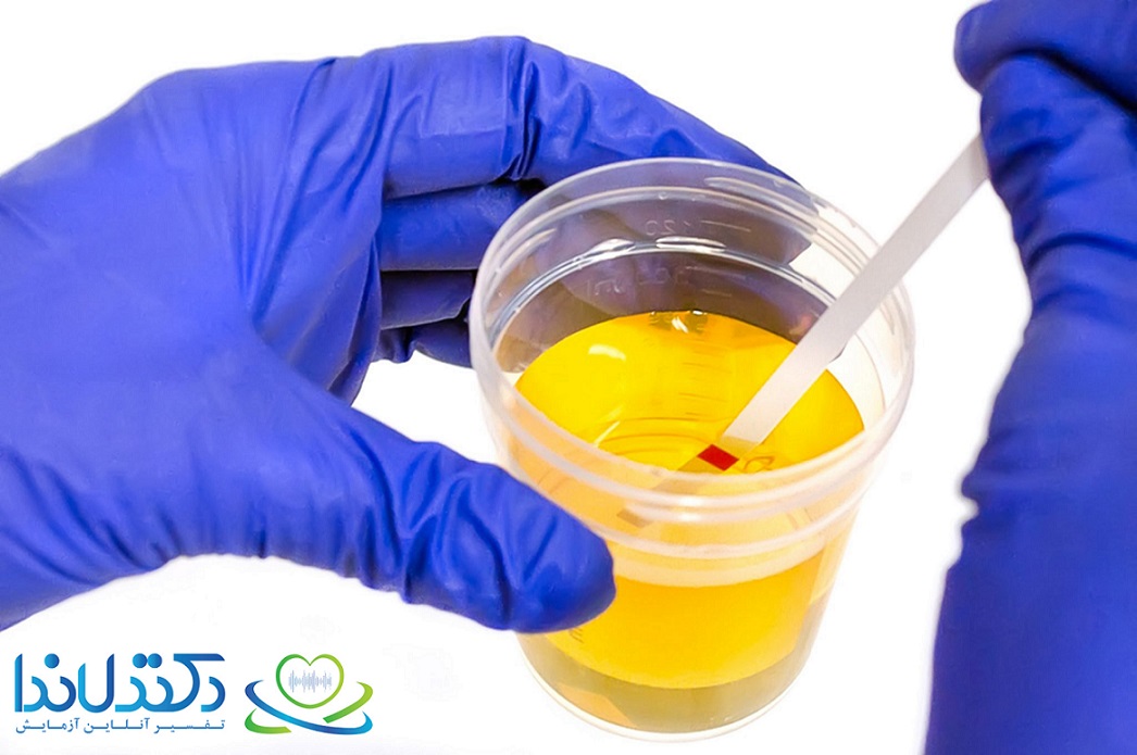 تفسیر آزمایش urine analysis