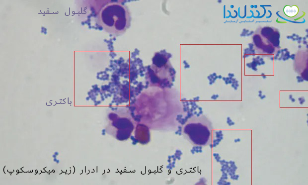 باکتری در ادرار و تفسیر آزمایش بیوشیمی ادرار دکتر لاندا