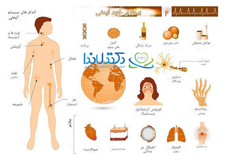 بیماری خود ایمنی