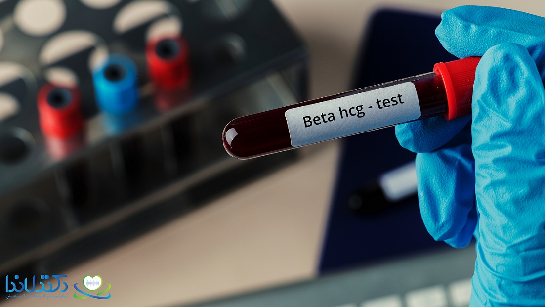 تفسیر آزمایش بتا اچ سی جی