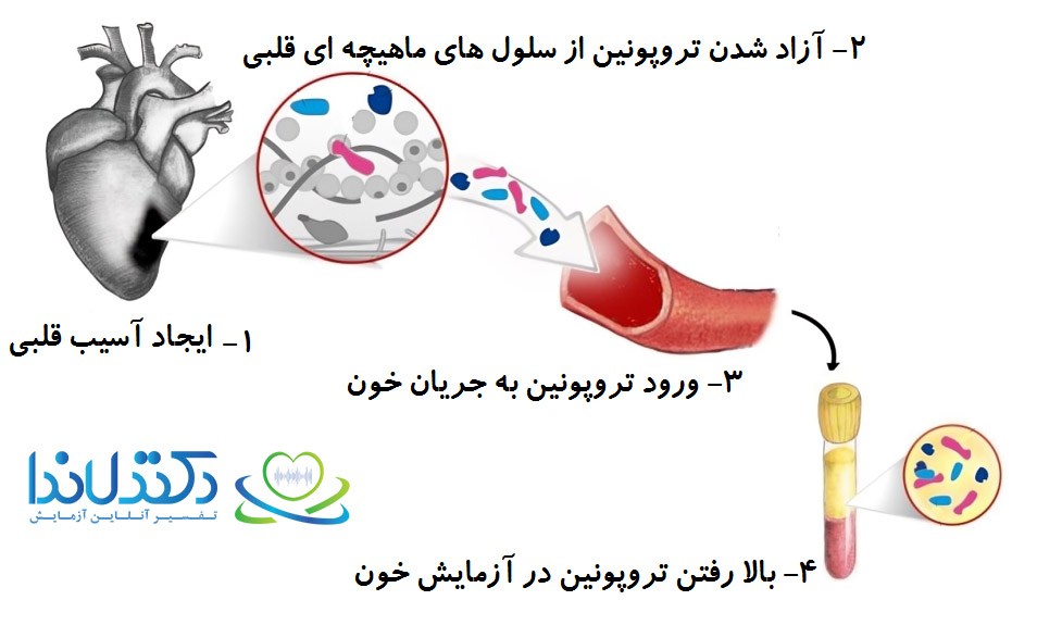 تفسیر آزمایش تروپونین دکتر لاندا