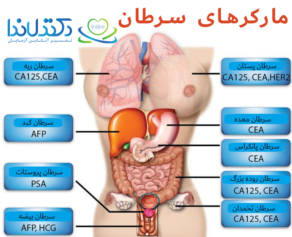 تفسیر آزمایش تومور مارکر دکتر لاندا