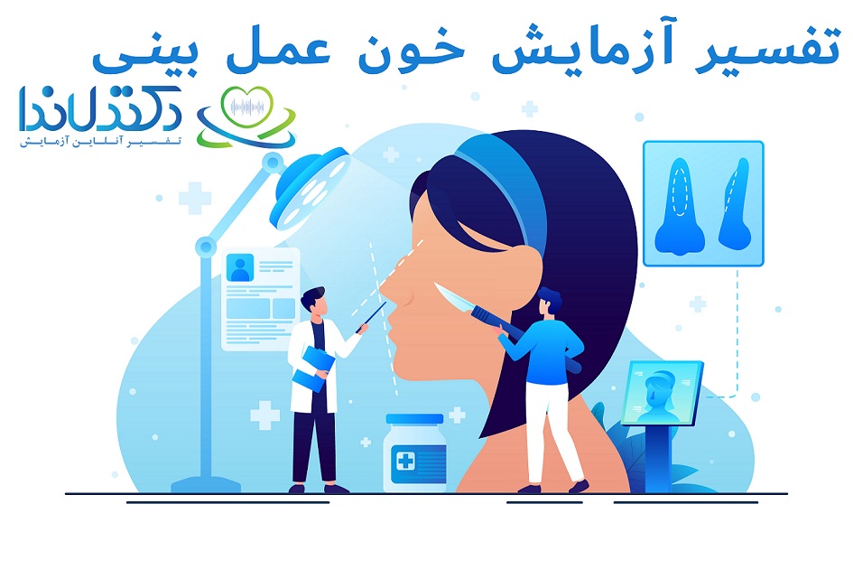 تفسیر آزمایش خون برای عمل بینی دکتر لاندا