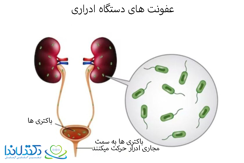 عفونت های دستگاه ادراری