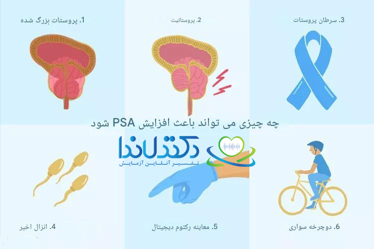 عوامل افزایش PSA