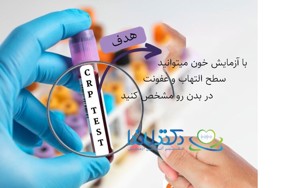 آزمایش عفونت خون crp