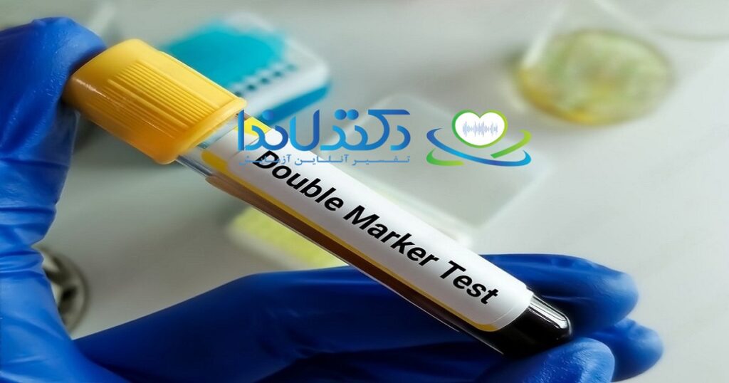 آزمایش دابل مارکر