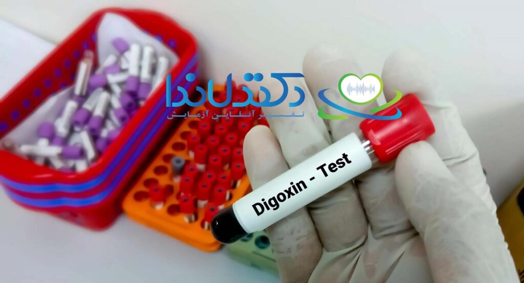 آزمایش دیگوکسین