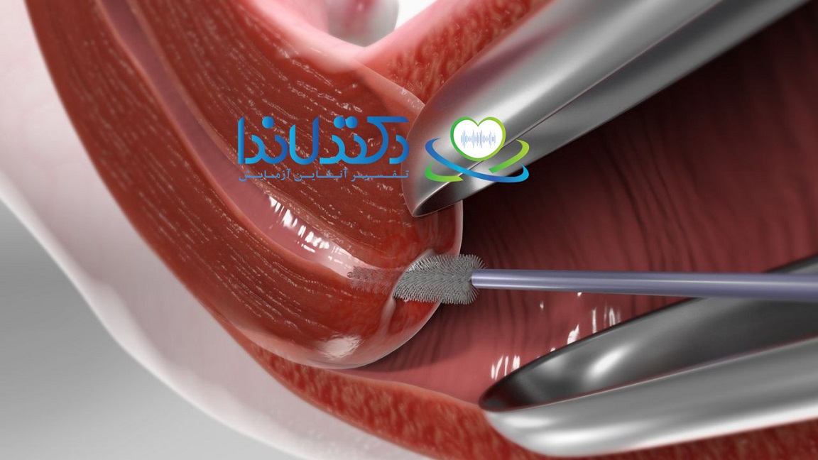 آزمایش پاپ اسمیر