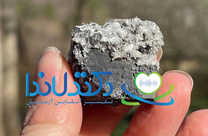 سرب، عنصری سنگین و خطرناک