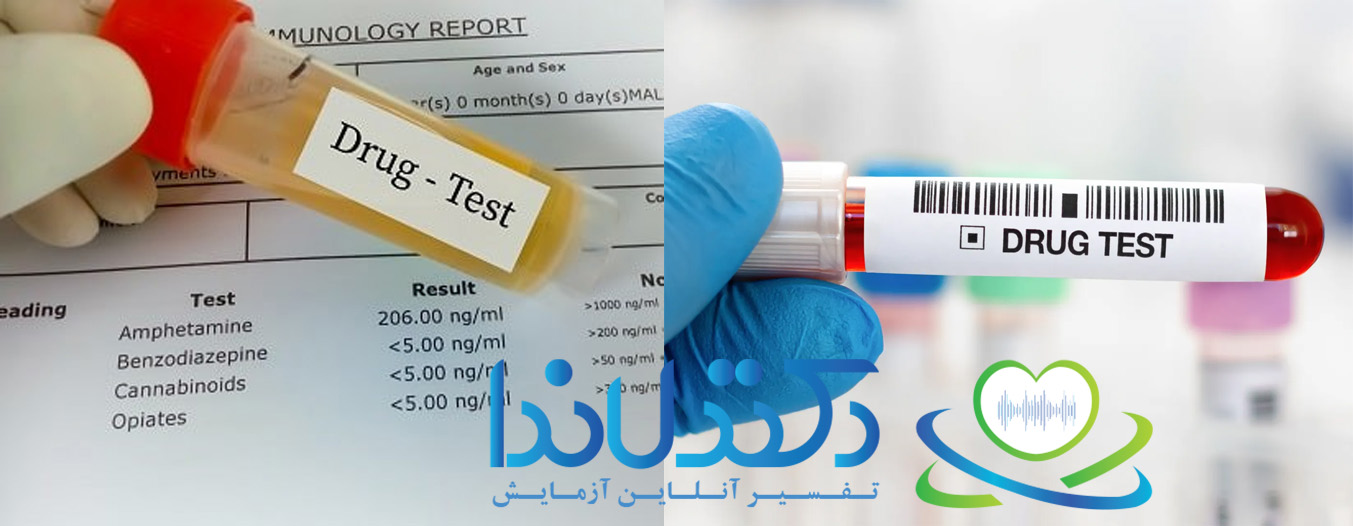 آزمایش عدم اعتیاد