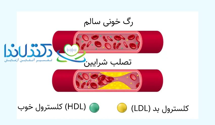 کلسترول بد و کلسترول خوب