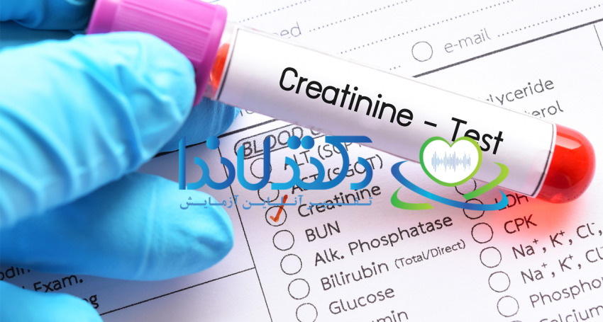 What is a creatinine test