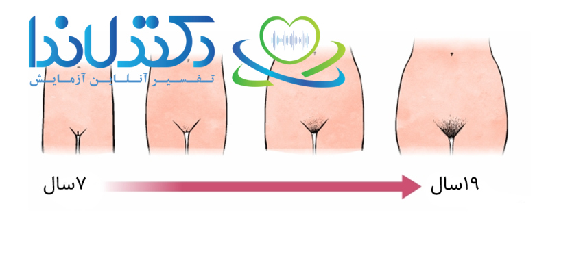 مراحل رشد اندام تناسلی زنان از ۷ تا ۱۹ سالگی — از آغاز بلوغ با تغییرات ظاهری و رویش مو تا تکامل کامل در سنین پایانی نوجوانی