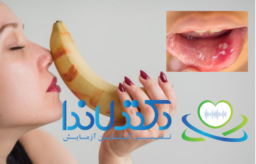 انتقال بیماری با رابطه جنسی دهانی