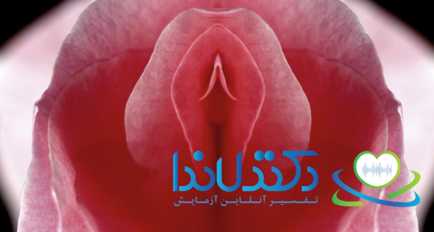 بافت لب‌های واژن با شکل و برجستگی متفاوت که می‌تواند دلیل جراحی لابیاپلاستی باشد