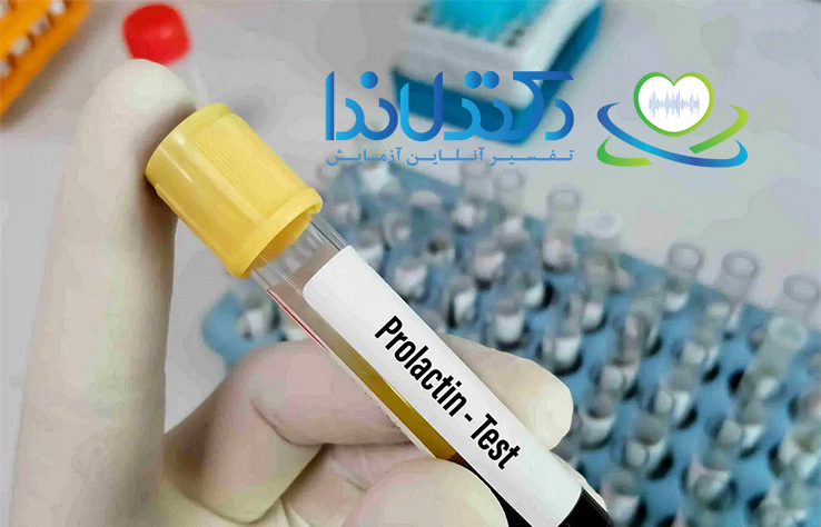 آزمایش پرولاکتین