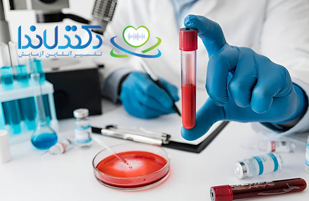 تفسیر آزمایش کورتیزول