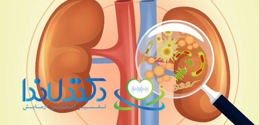 عفونت کلیه (پیلونفریت) اغلب توسط باکتری‌ها ایجاد شده و می‌تواند باعث التهاب شدید و آسیب به بافت کلیه شود. تشخیص و درمان به موقع برای پیشگیری از عوارض حیاتی است.