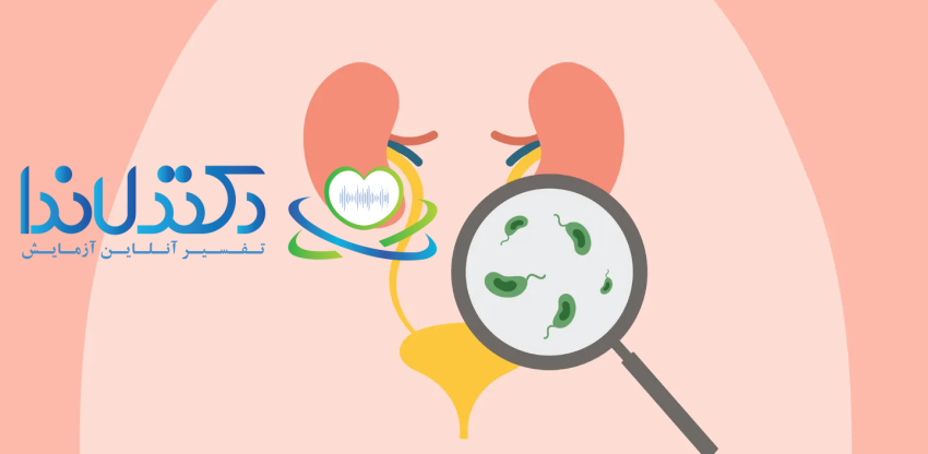 نمایی ساده از دستگاه ادراری و وجود باکتری‌ها، عامل اصلی بروز عفونت ادراری (UTI) در کلیه و مثانه.