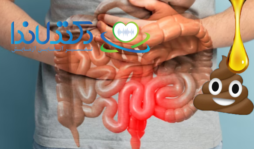 لوبریکانت برای یبوست