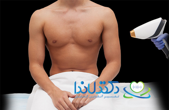 لیزر ناحیه تناسلی مردان