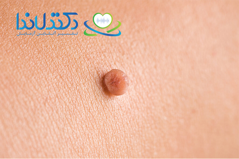 اسکین تگ ناحیه تناسلی زنان