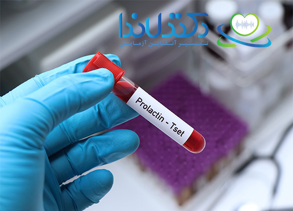 آزمایش پرولاکتین برای چیست