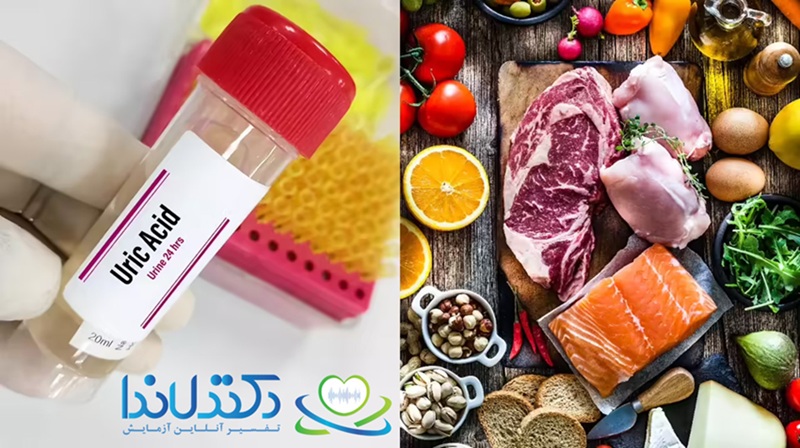 تفسیر آزمایش نقرس