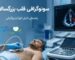 Adult heart ultrasound
