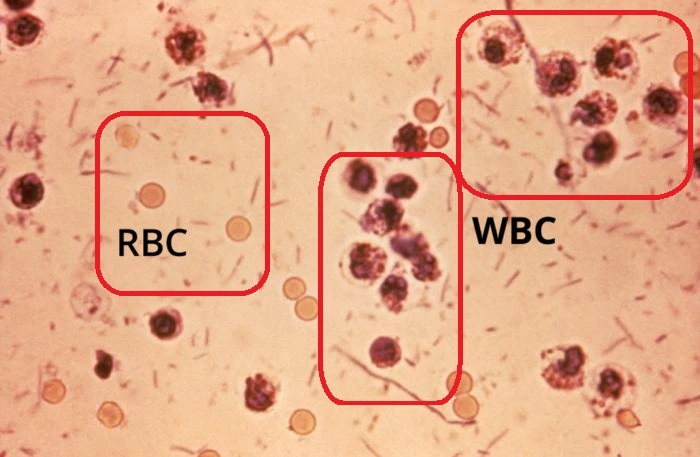 WBC در آزمایش مدفوع چیست؟ | مقدار نرمال، WBC 1-2 و معنی HPF
